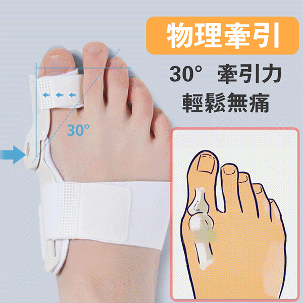 拇外翻矯正器